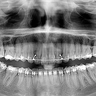 Clínica Dental Viana radiografía dental